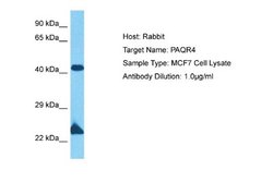 PAQR4 Rabbit anti-Human, Polyclonal, Novus Biologicals 0.1 mL | Buy Online | Novus Biologicals | Fisher Scientific